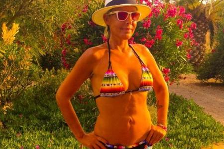 Natascha Ochsenknecht hat kein Problem mit ihren Narben