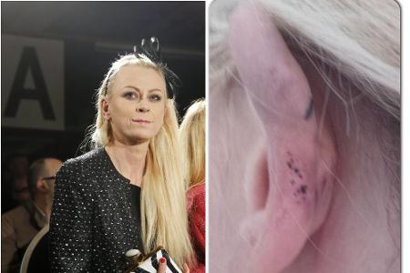 Jenny Elvers hat sich im Urlaub am Ohr verletzt