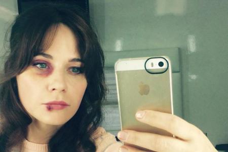 Zooey Deschanel mit blauem Auge und aufgeschlagener Lippe