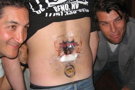 Schmerzen gehören dazu.