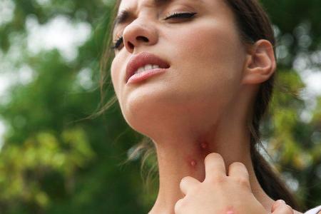 Auch diverse Kräuter halten Mücken fern.