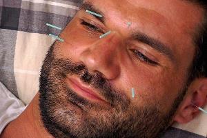 Mike ausnahmsweise entspannt bei Michelles Akupunktur.