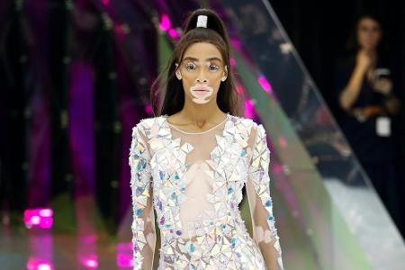 Winnie Harlow hat durch ihre Erkrankung Vitiligo großen Wiedererkennungswert. Nachdem die Kanadierin 2014 an 