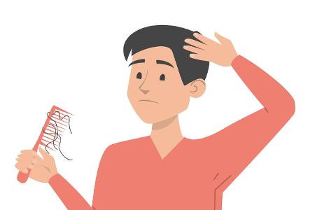 Das kostet eine Haartransplantation