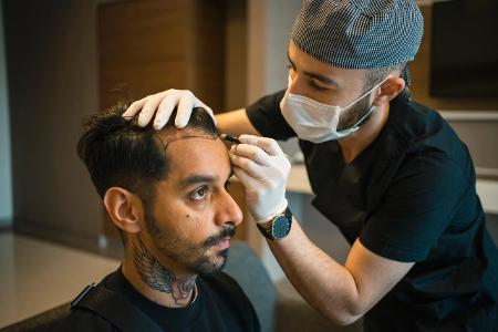 Das kostet eine Haartransplantation