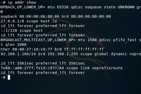 Die Ausgabe von ip addr show unter Kali Linux in Virtual Box.