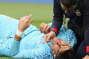 Iran-Keeper Beiranvand mit Verdacht auf Gehirnerschütterung