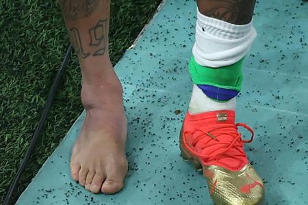 Neymars Knöchel verstaucht - weitere Untersuchungen folgen