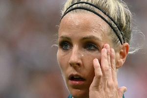 Muskuläre Probleme: DFB-Frauen gegen Schweden ohne Lohmann