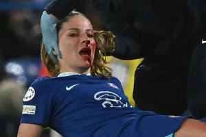 Leupolz bleibt trotz Nasenbeinbruchs beim DFB-Team