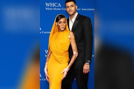 Model Winnie Harlow zeigt: So edel kann Orange aussehen