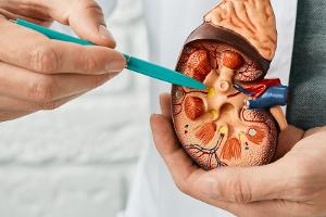 Eine Ärztin klärt auf: Nierensteine verstehen, vorbeugen und behandeln