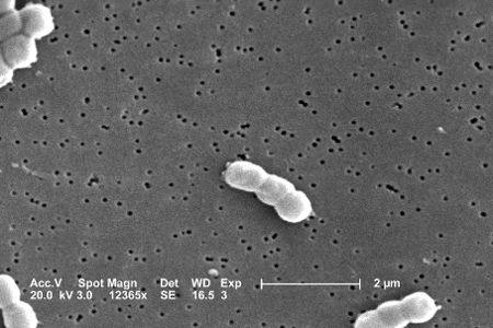 ACINETOBACTER BAUMANNII