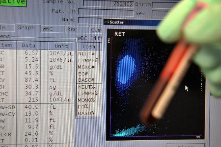 NADA untersucht erstmals digitale Matrix alter Proben