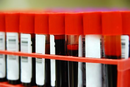 Ständer mit Röhrchen im Labor