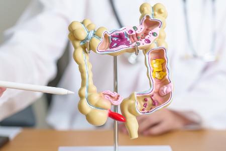 Krebsvorsorge: Diese regelmäßigen Check-ups sind wichtig