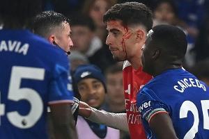 Mit blutendem Havertz: Arsenal verpasst Derbysieg