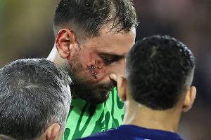 Donnarummas Stollen-Verletzung: "Man muss Spieler schützen"