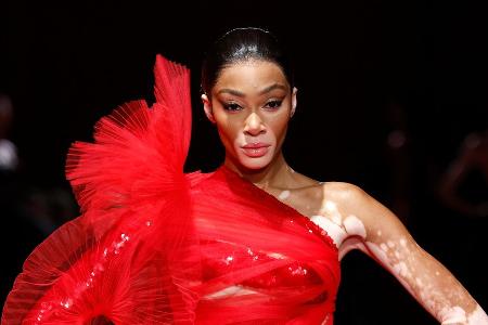 Model Winnie Harlow verkündet Verlobung