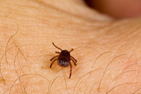 Zecke krabbelt auf menschlicher Haut herum