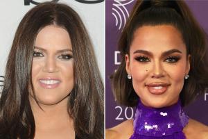Khloé Kardashian packt über alle Beauty-Eingriffe aus