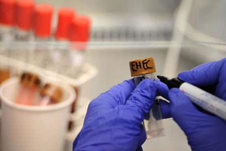 Rinder-Salami wird wegen einer möglichen bakteriellen Belastung zurückgerufen. (Symbolbild) 