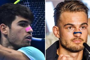 Nasenpflaster zur besseren Atmung? Das bringt der Hype wirklich