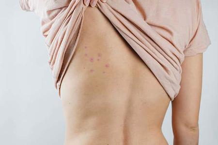 Ungeziefer im Wohnwagen