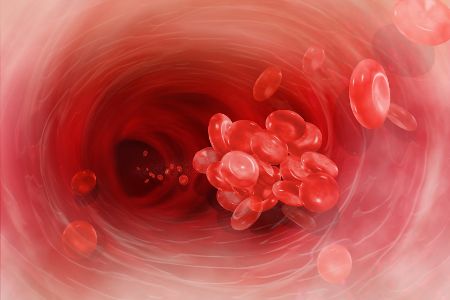 Digitales Bild einer Vene mit Blutgerinnsel