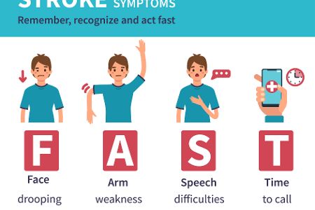 Grafik zum FAST-Test gegen Schlaganfälle