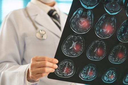 Arzt zeigt verschiedene Scans eines Gehirns