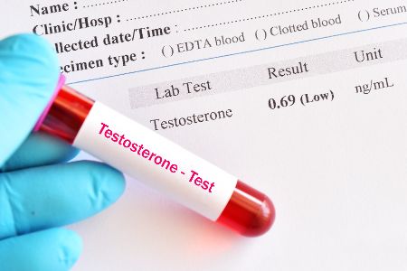 Testosteron-Bluttest und Ergebnisse