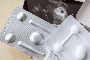 Zum ersten Mal wurde bei Schwangerschaftsabbrüchen das Medikament Mifegyne häufiger genutzt als die Absaugmethode. (Archivbild)