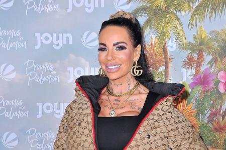 Nach Operation: Gina-Lisa Lohfink hat Angst um ihr Bein