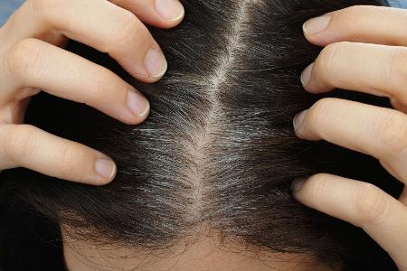 Mittel gegen graue Haare
