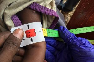 Schon jetzt gelten fast zwei Millionen Kinder in Somalia akut unterernährt. (Archivbild)
