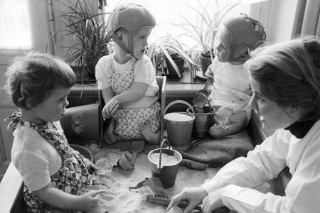 Missbildungen waren die Folge von Contergan-Einnahme während der Schwangerschaft. (Archiv)