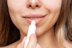 Trockene Lippen: Diese Fehler machen sie noch spröder