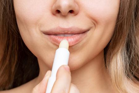 Trockene Lippen: Diese Fehler machen sie noch spröder